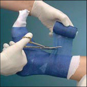 Venda scotch cast azul 10.0cm x 3.65m