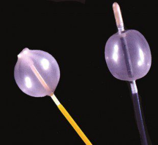 Cateter fogarty cateter fogarty para embolectomia 2fr 60cm
