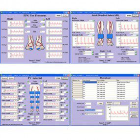 Software V-Link O Fetal Link para PC Windows para mini doppler
