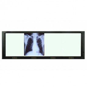 Negatoscopio cuadruple de pared con luz LED